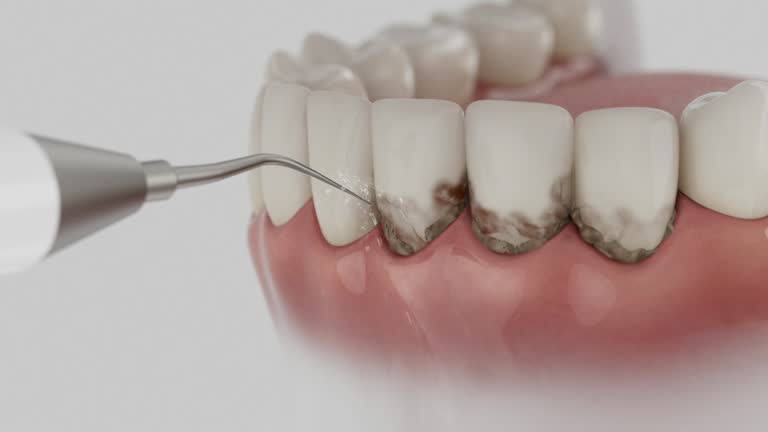 Trusted Teeth Cleaning And Checkup service in Norlina, NC - Dentist Open Now